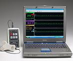 Vmed PC-Vet &nbsp;Hand-Held Wireless Lead II ECG Monitor